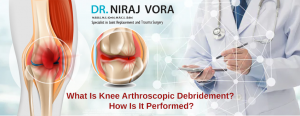 Knee Arthroscopic Debridement