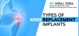 Types of Knee Replacement Implants | Dr Niraj Vora