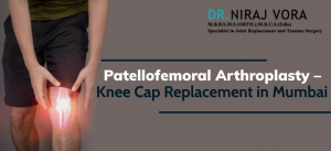 patellofemoral arthroplasty – knee cap replacement in mumbai
