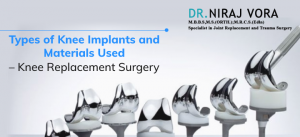 Types of Knee Implants and Materials Used | Knee Replacement Surgery