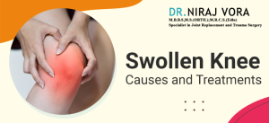 Swollen Knee Causes and Treatment | Dr Niraj Vora